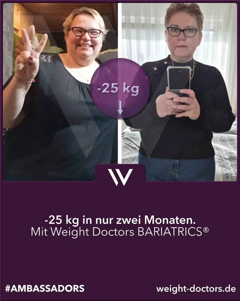 Weight Doctors® Vorher-Nachher: Patientin mit 25 kg weniger in zwei Monaten, mit Weight Doctors BARIATRICS®