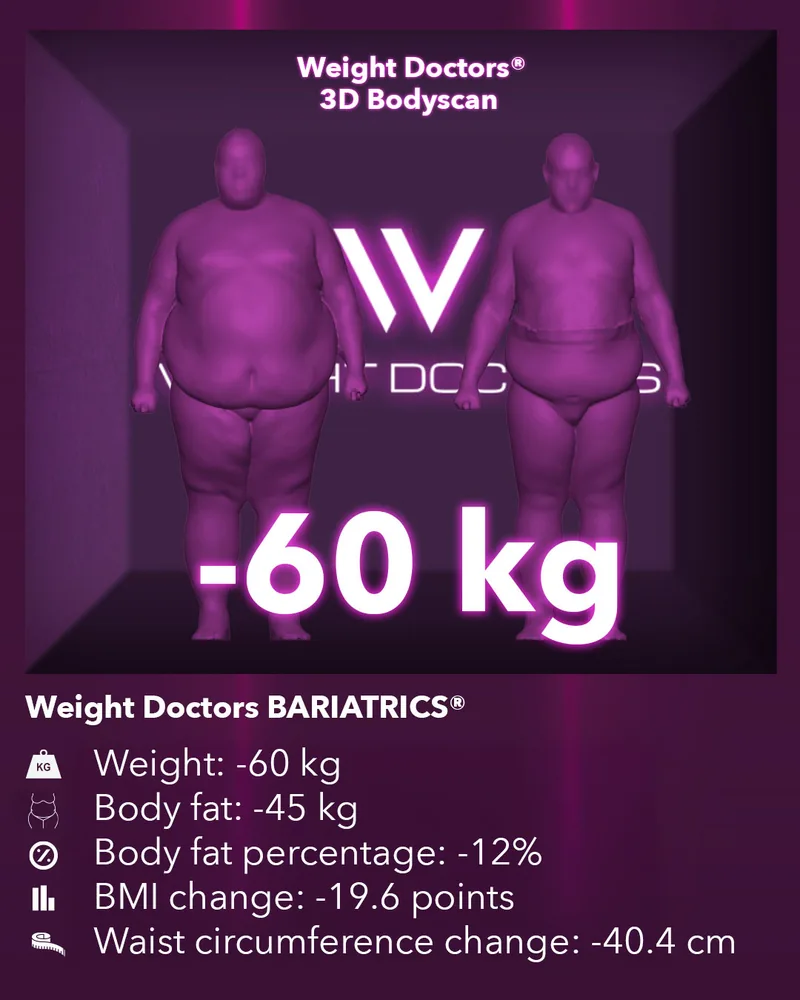 Weight Doctors® 3D-Bodyscan قبل وبعد: ناقص 60 kg مع Weight Doctors BARIATRICS®، ودهون الجسم ناقص 45 kg