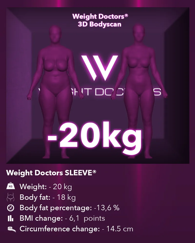Weight Doctors® 3D Bodyscan before and after: minus 20 kg with Weight Doctors SLEEVE®, body fat minus 18 kg