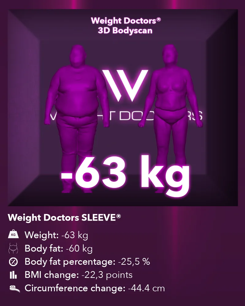 Weight Doctors® 3D-Bodyscan قبل وبعد: ناقص 63 kg مع Weight Doctors SLEEVE®، ودهون الجسم ناقص 60 kg