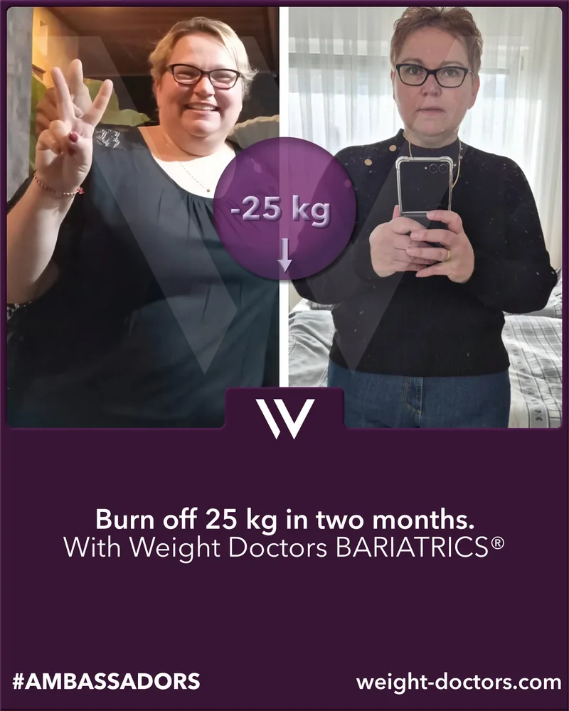 Weight Doctors® قبل وبعد: مريضة فقدت 25 kg في شهرين، مع Weight Doctors BARIATRICS®