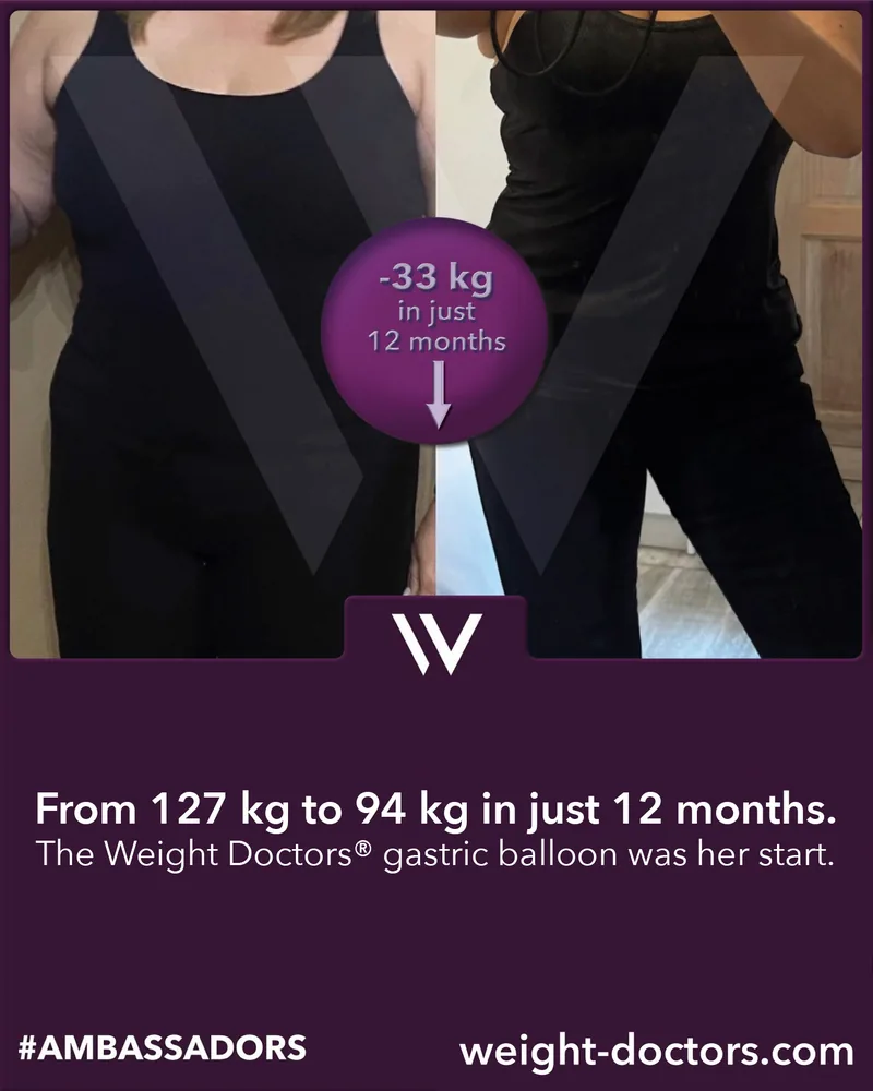 Weight Doctors® قبل وبعد: مريضة من 127 kg إلى 94 kg في اثني عشر شهرًا، مع Weight Doctors® بالون المعدة