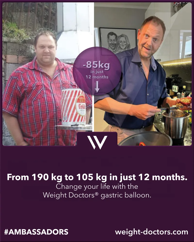 Weight Doctors® قبل وبعد: مريض من 190 kg إلى 105 kg في اثني عشر شهرًا، مع Weight Doctors® بالون المعدة