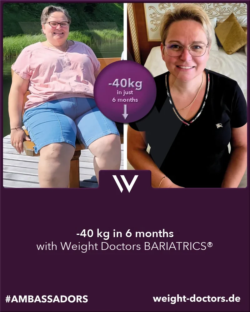 Weight Doctors® قبل وبعد: مريضة بوزن أقل بـ 40 kg في ستة أشهر، مع Weight Doctors BARIATRICS®