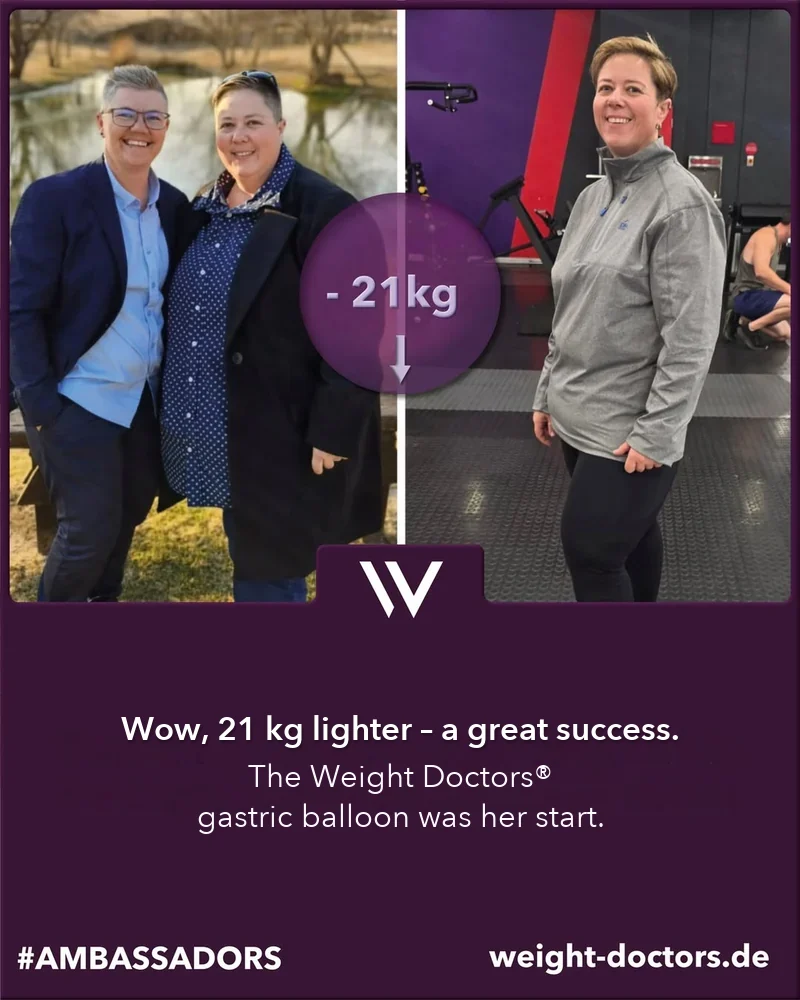 Weight Doctors® قبل وبعد: Elli بوزن أقل بـ 21 kg، مع Weight Doctors® بالون المعدة