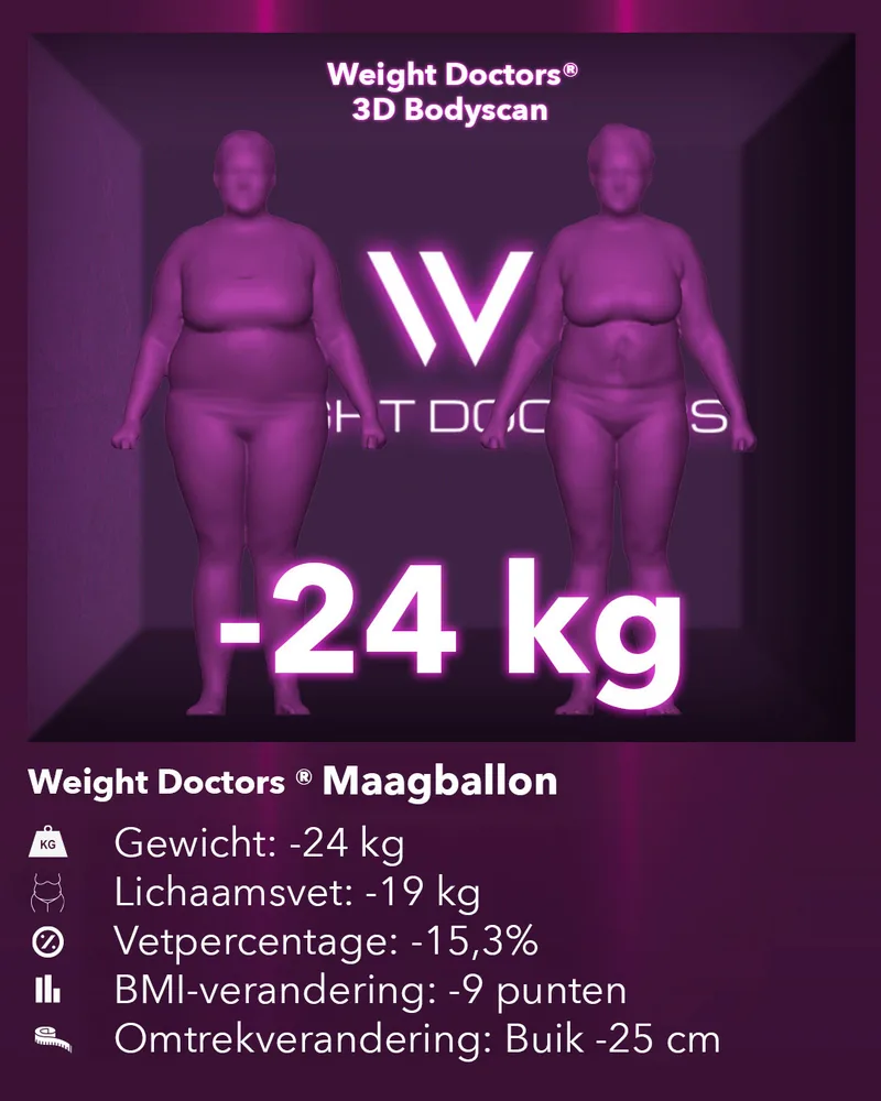 Weight Doctors® 3D Bodyscan voor en na: min 24 kg met de Weight Doctors® MAAGBALLON, lichaamsvet min 19 kg