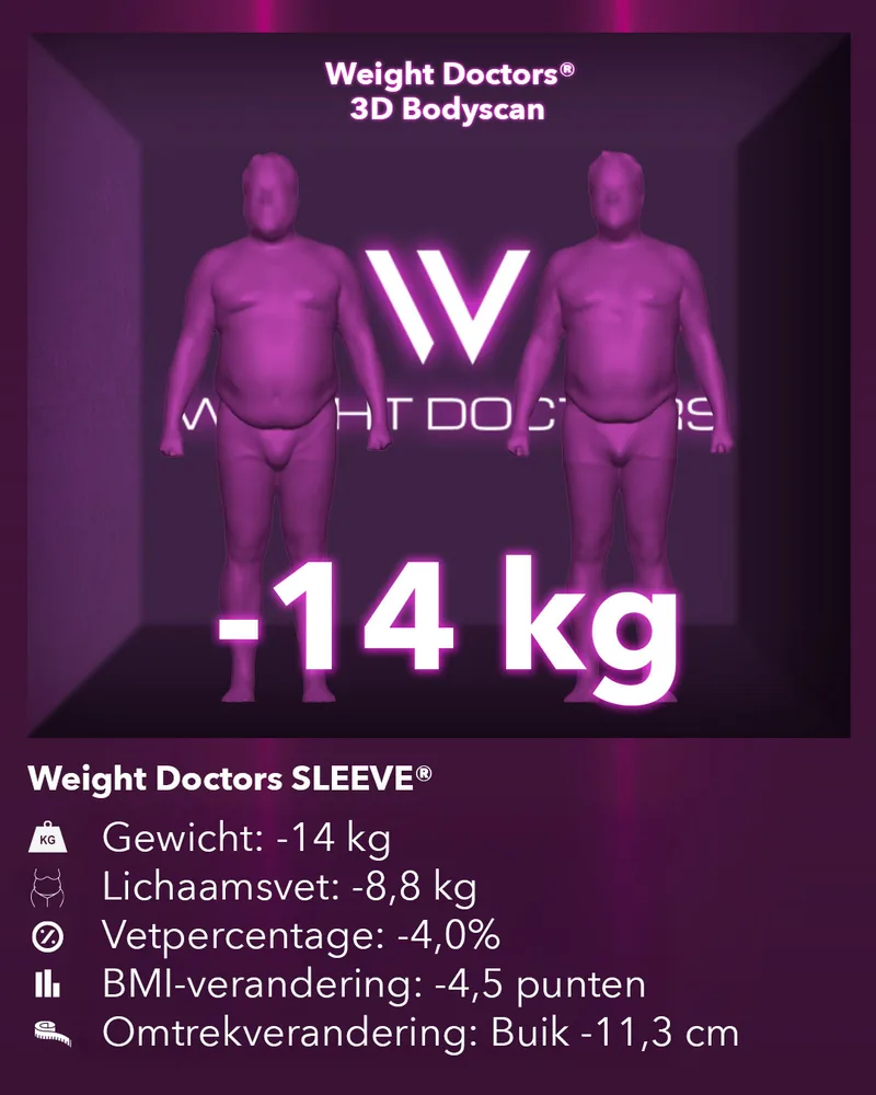 Weight Doctors® 3D-bodyscan voor en na: min 14 kg met Weight Doctors SLEEVE®, lichaamsvet min 8,8 kg