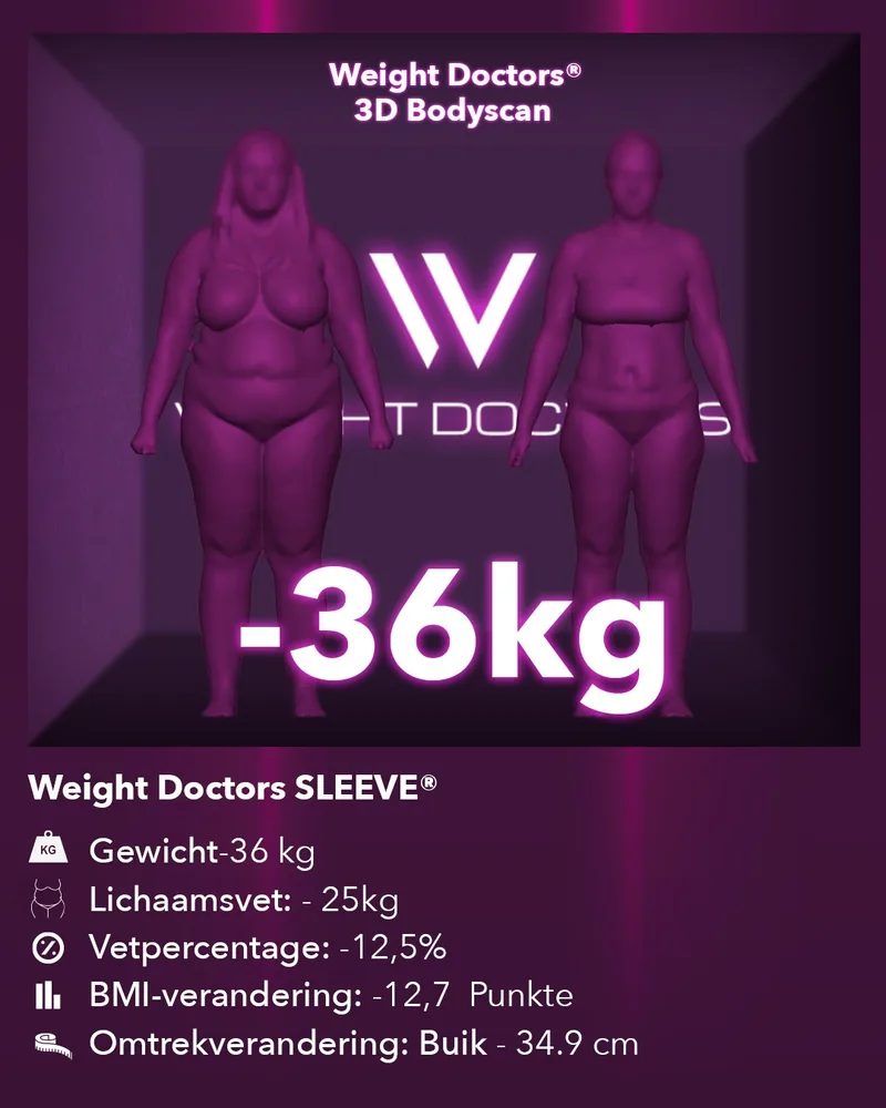 Weight Doctors® 3D Bodyscan voor en na: min 36 kg met Weight Doctors SLEEVE®, lichaamsvet min 25 kg