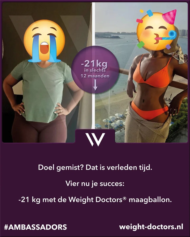 Weight Doctors® voor en na: patiënte met 21 kg minder in twaalf maanden, met de Weight Doctors® MAAGBALLON (gezichten afgedekt)
