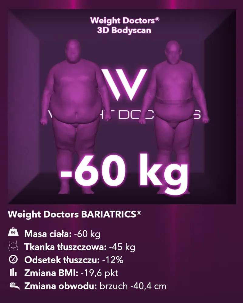 Weight Doctors® 3D Bodyscan przed i po: minus 60 kg z Weight Doctors BARIATRICS®, tkanka tłuszczowa minus 45 kg