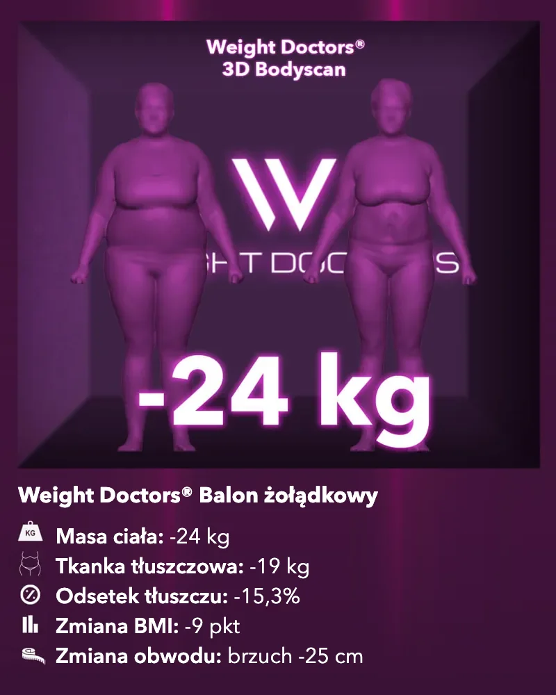 Weight Doctors® 3D Bodyscan przed i po: minus 24 kg z Weight Doctors® BALON ŻOŁĄDKOWY, tkanka tłuszczowa minus 19 kg