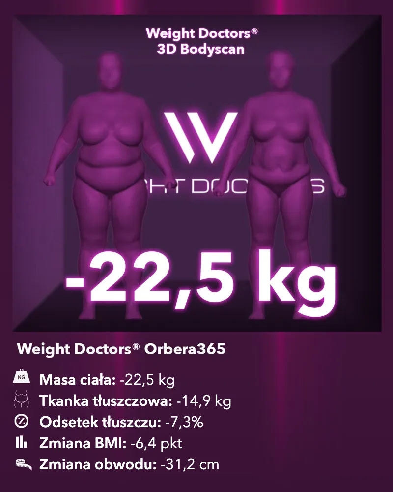 Weight Doctors® 3D Bodyscan przed i po: minus 22,5 kg z balonem żołądkowym Orbera365, tkanka tłuszczowa minus 14,9 kg