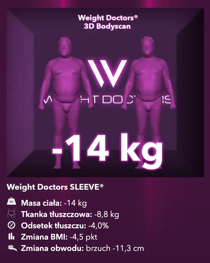 Weight Doctors® 3D-Bodyscan przed i po: minus 14 kg z Weight Doctors SLEEVE®, tkanka tłuszczowa minus 8,8 kg