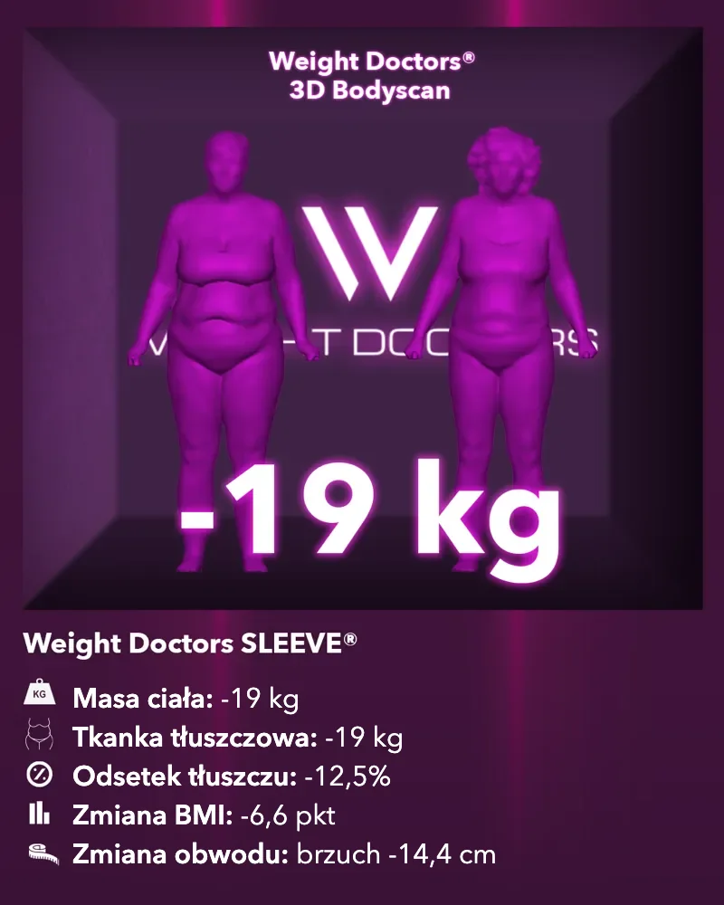 Weight Doctors® 3D-Bodyscan przed i po: minus 19 kg z Weight Doctors SLEEVE®, tkanka tłuszczowa minus 19 kg