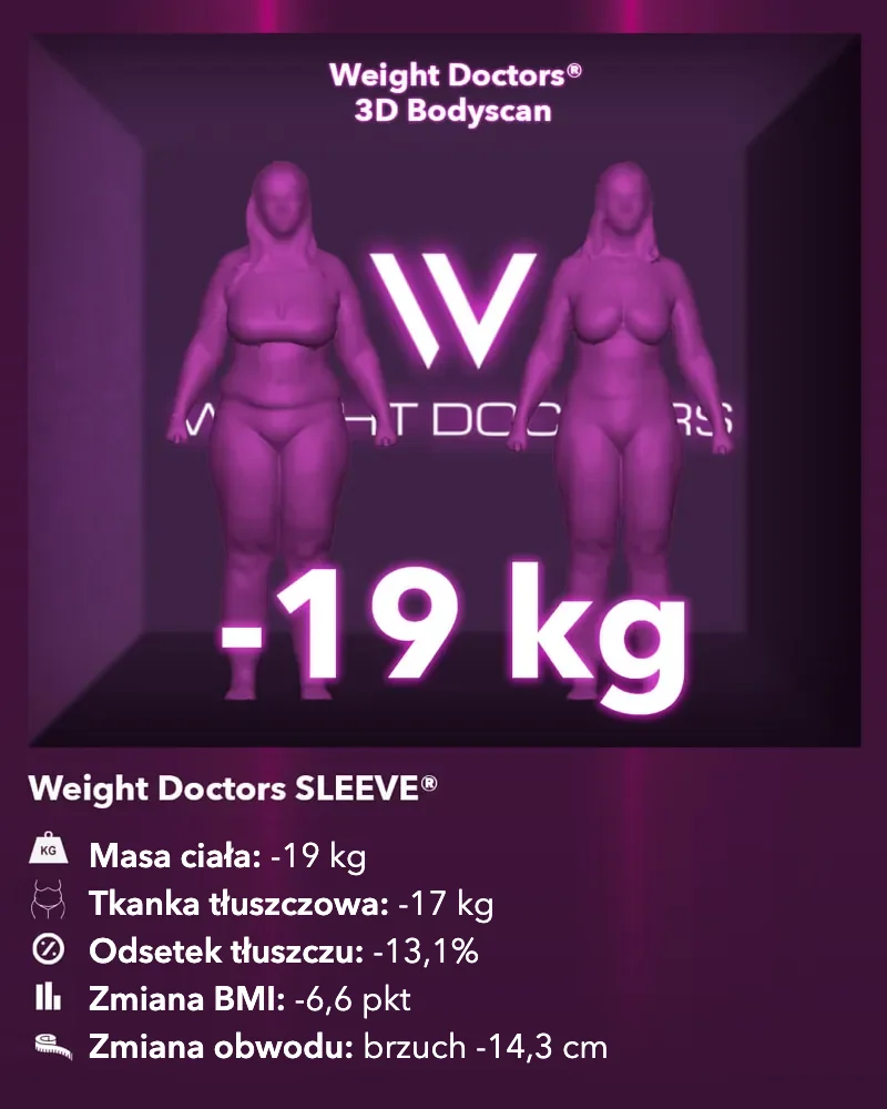 Weight Doctors® 3D-Bodyscan przed i po: minus 19 kg z Weight Doctors SLEEVE®, tkanka tłuszczowa minus 17 kg