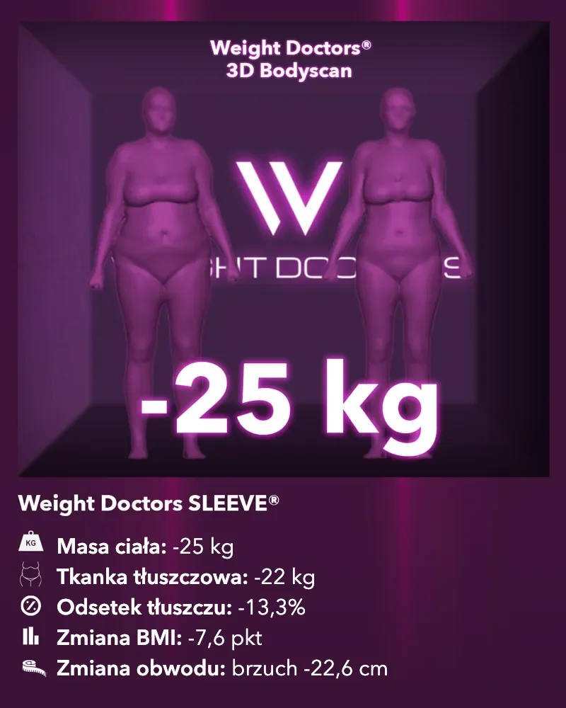 Weight Doctors® 3D Bodyscan przed i po: minus 25 kg z Weight Doctors SLEEVE®, tkanka tłuszczowa minus 22 kg