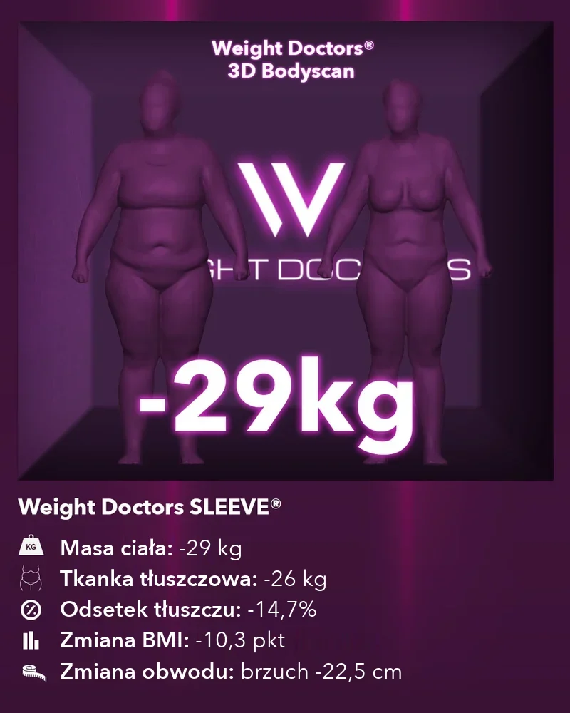 Weight Doctors® 3D Bodyscan przed i po: minus 29 kg z Weight Doctors SLEEVE®, tkanka tłuszczowa minus 26 kg