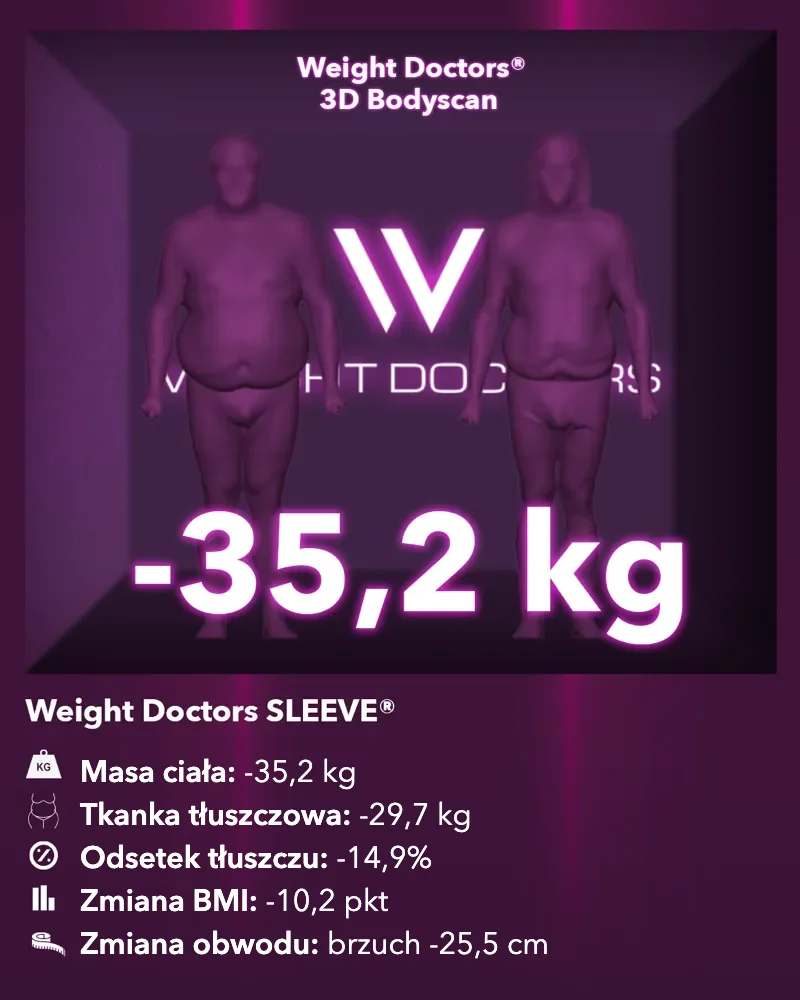 Weight Doctors® 3D Bodyscan przed i po: minus 35,2 kg z Weight Doctors SLEEVE®, tkanka tłuszczowa minus 29,7 kg