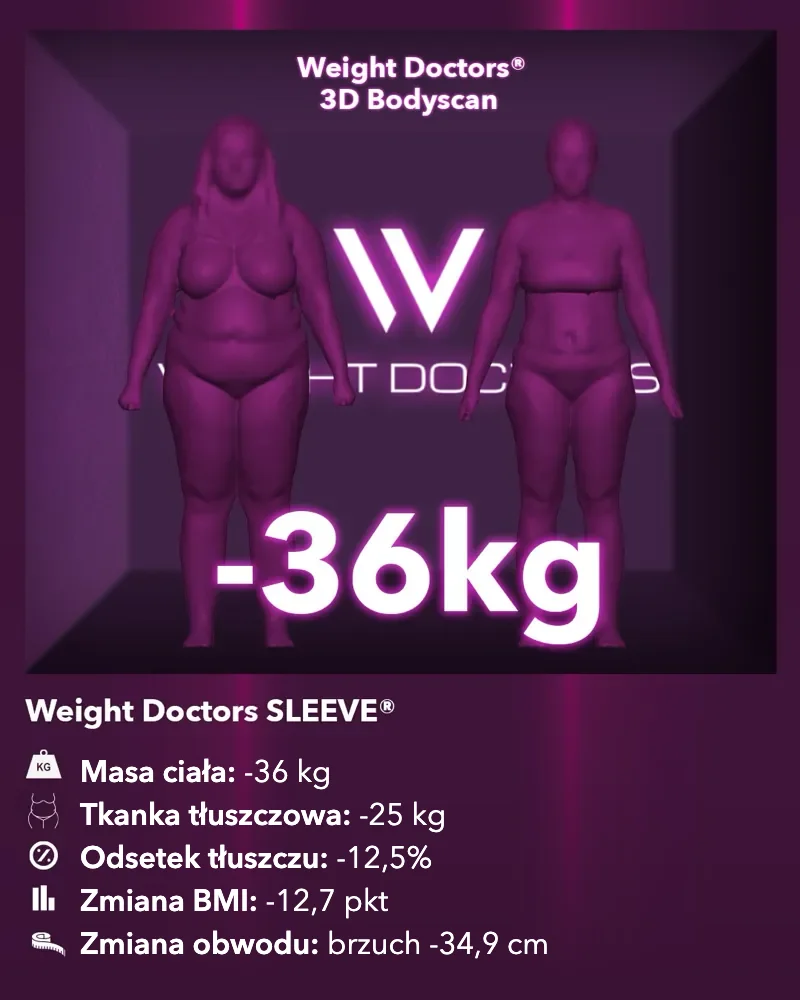 Weight Doctors® 3D Bodyscan przed i po: minus 36 kg z Weight Doctors SLEEVE®, tkanka tłuszczowa minus 25 kg