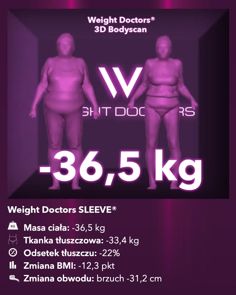 Weight Doctors® 3D Bodyscan przed i po: minus 36,5 kg z Weight Doctors SLEEVE®, tkanka tłuszczowa minus 33,4 kg