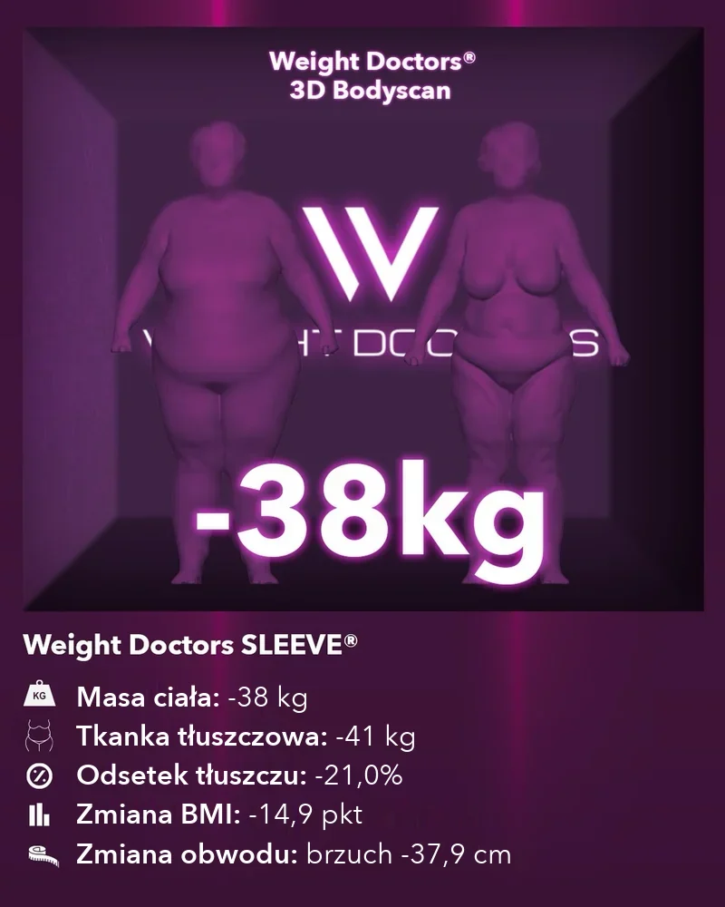 Weight Doctors® 3D Bodyscan przed i po: minus 38 kg z Weight Doctors SLEEVE®, tkanka tłuszczowa minus 41 kg