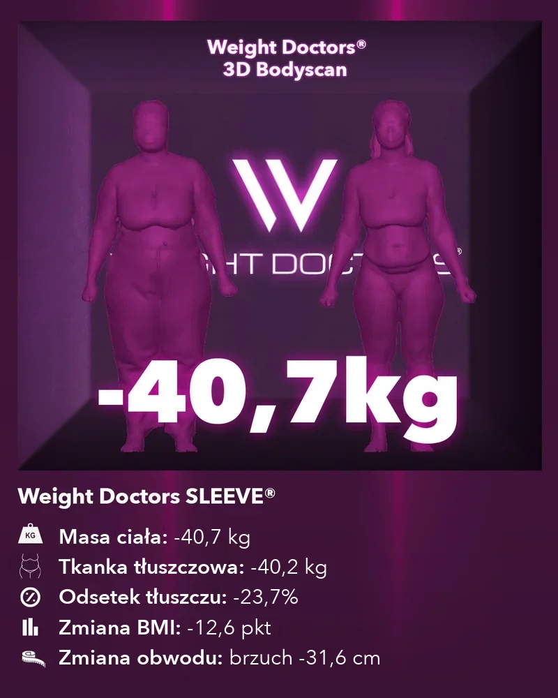 Weight Doctors® 3D Bodyscan przed i po: minus 40,7 kg z Weight Doctors SLEEVE®, tkanka tłuszczowa minus 40,2 kg