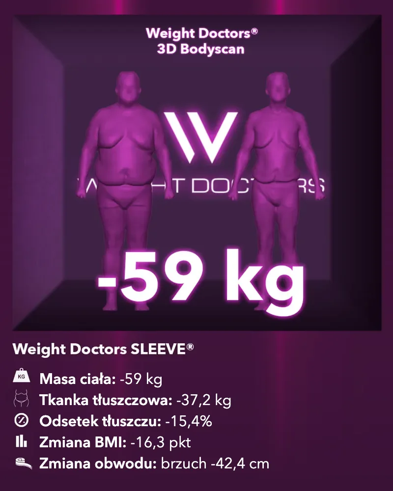 Weight Doctors® 3D Bodyscan przed i po: minus 59 kg z Weight Doctors SLEEVE®, tkanka tłuszczowa minus 37,2 kg
