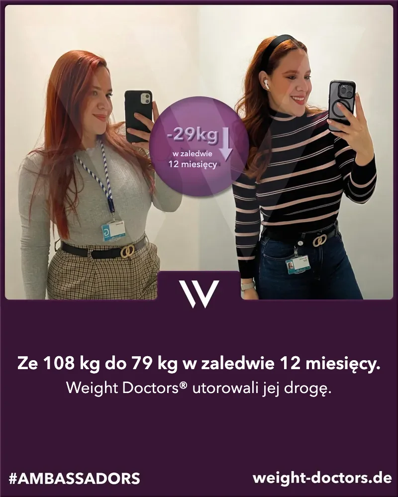Weight Doctors® przed i po: pacjentka – ze 108 kg do 79 kg w dwanaście miesięcy