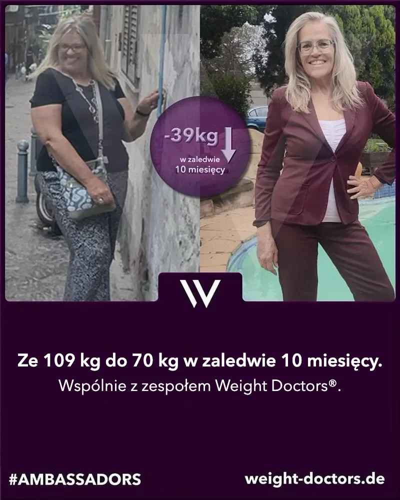 Weight Doctors® przed i po: pacjentka – ze 109 kg do 70 kg w dziesięć miesięcy, razem z zespołem Weight Doctors®