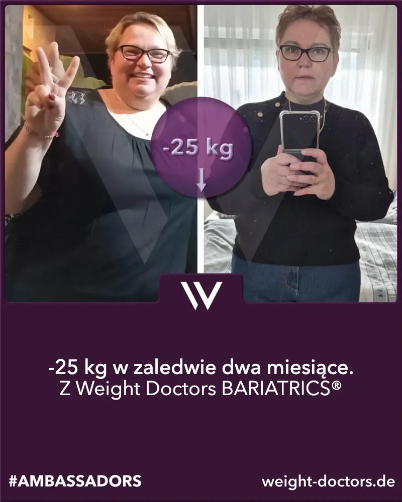 Weight Doctors® przed i po: pacjentka – 25 kg mniej w dwa miesiące, z Weight Doctors BARIATRICS®