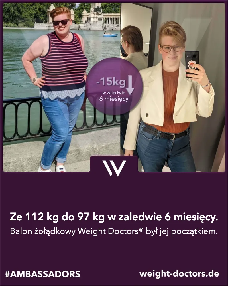 Weight Doctors® przed i po: pacjentka – z 112 kg do 97 kg w sześć miesięcy, z Weight Doctors® BALON ŻOŁĄDKOWY