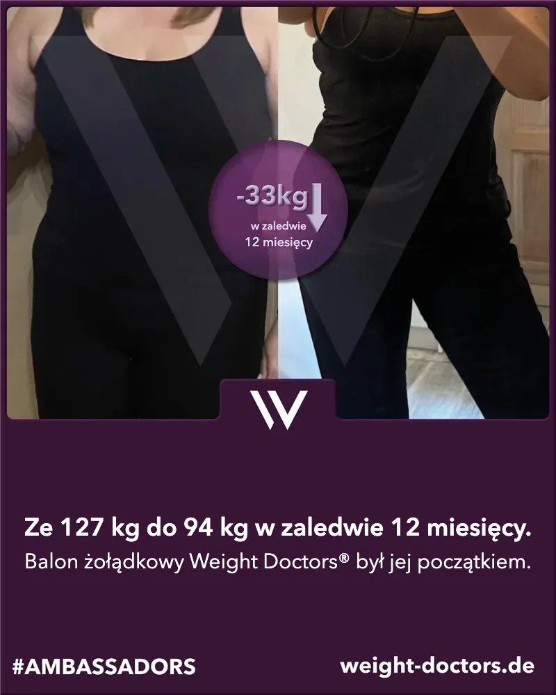 Weight Doctors® przed i po: pacjentka – z 127 kg do 94 kg w dwanaście miesięcy, z Weight Doctors® BALON ŻOŁĄDKOWY
