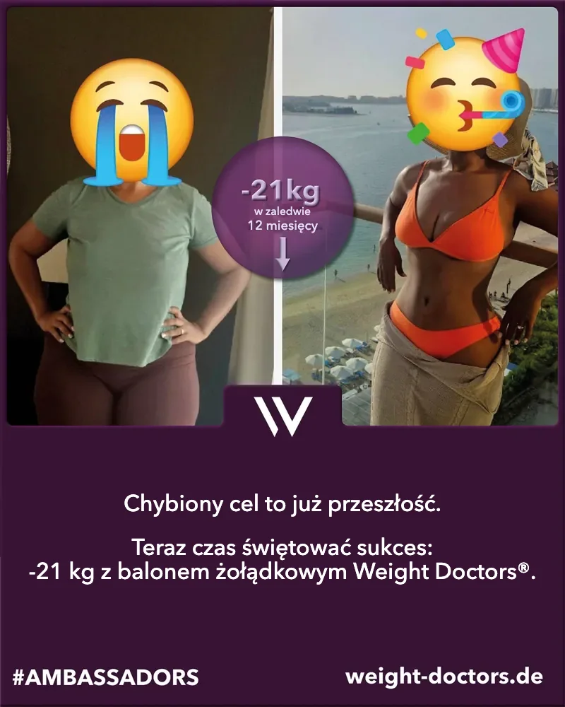 Weight Doctors® przed i po: pacjentka – 21 kg mniej w dwanaście miesięcy, z Weight Doctors® BALON ŻOŁĄDKOWY (twarze zakryte)