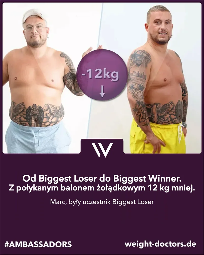 Weight Doctors® przed i po: Marc, były uczestnik programu „The Biggest Loser”, 12 kg mniej z balonem żołądkowym Allurion