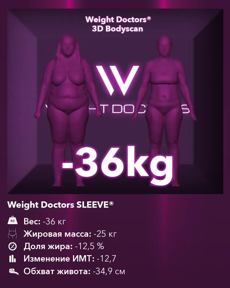 Weight Doctors® 3D Bodyscan до и после: минус 36 кг с Weight Doctors SLEEVE®, жировая масса минус 25 кг