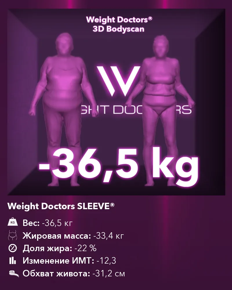 Weight Doctors® 3D Bodyscan до и после: минус 36,5 кг с Weight Doctors SLEEVE®, жировая масса минус 33,4 кг