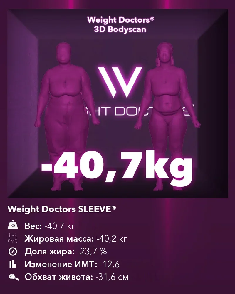 Weight Doctors® 3D Bodyscan до и после: минус 40,7 кг с Weight Doctors SLEEVE®, жировая масса минус 40,2 кг