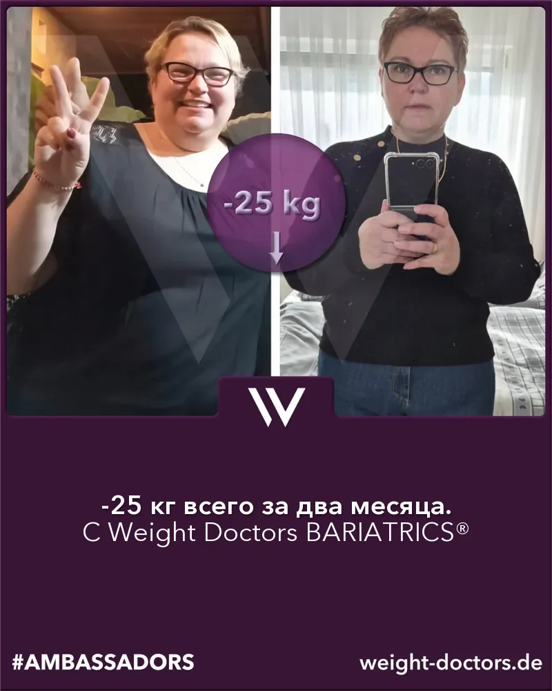 Weight Doctors® до и после: пациентка на 25 кг легче за два месяца с Weight Doctors BARIATRICS®
