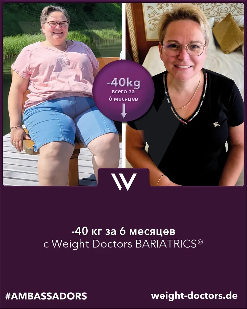 Weight Doctors® до и после: пациентка на 40 кг легче за шесть месяцев с Weight Doctors BARIATRICS®