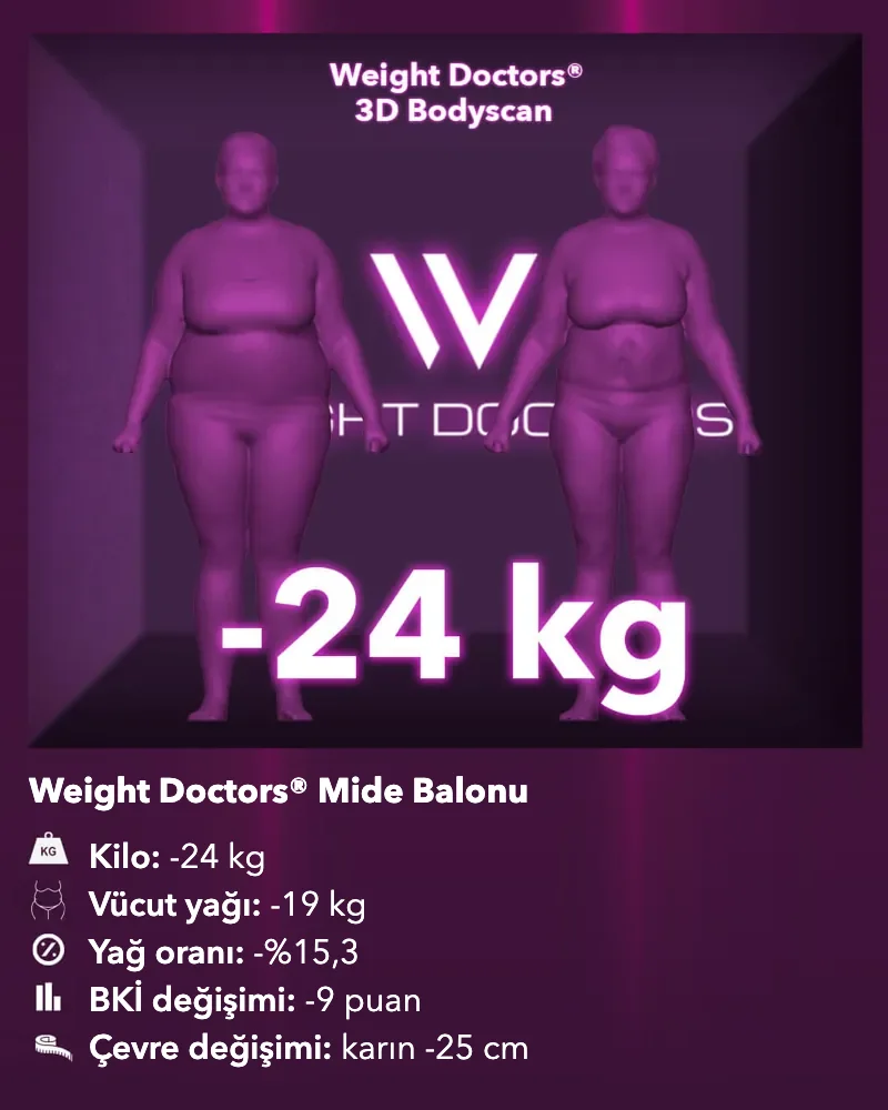 Weight Doctors® 3D Bodyscan öncesi ve sonrası: Weight Doctors® MİDE BALONU ile 24 kg eksi, vücut yağı 19 kg eksi