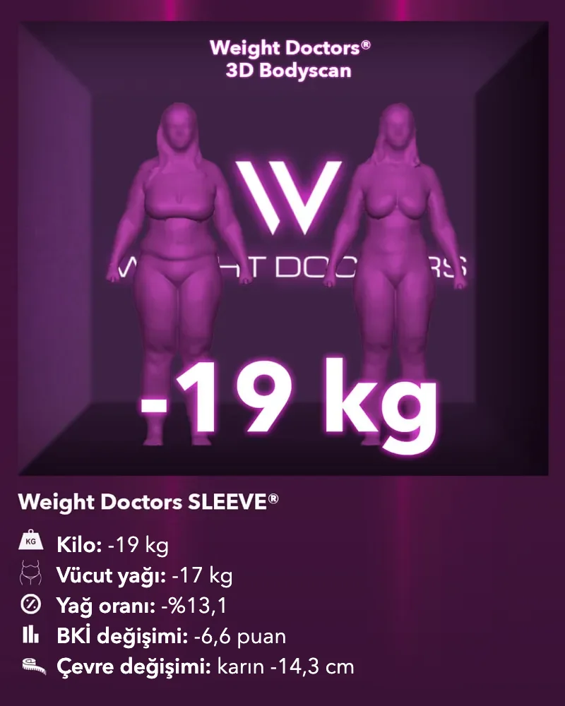 Weight Doctors® 3D Bodyscan öncesi ve sonrası: Weight Doctors SLEEVE® ile 19 kg eksi, vücut yağı 17 kg eksi