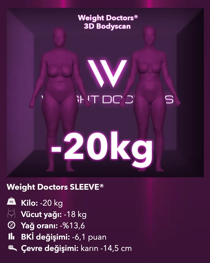Weight Doctors® 3D Bodyscan öncesi ve sonrası: Weight Doctors SLEEVE® ile 20 kg eksi, vücut yağı 18 kg eksi