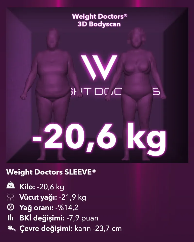Weight Doctors® 3D Bodyscan öncesi ve sonrası: Weight Doctors SLEEVE® ile 20,6 kg eksi, vücut yağı 21,9 kg eksi