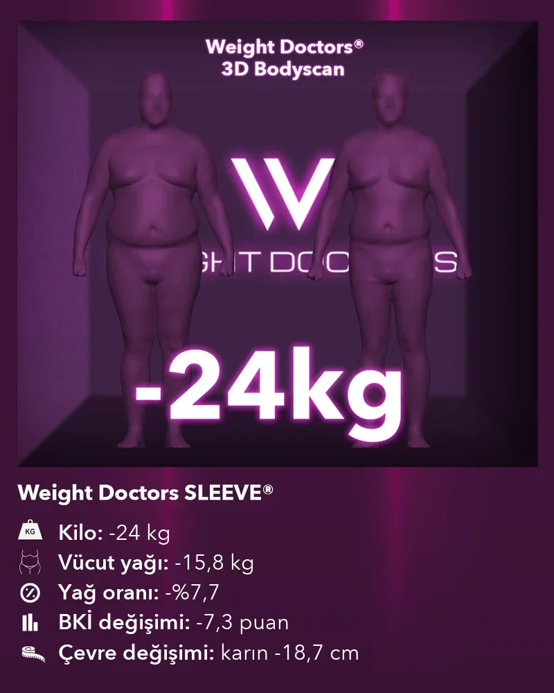 Weight Doctors® 3D Bodyscan öncesi ve sonrası: Weight Doctors SLEEVE® ile 24 kg eksi, vücut yağı 15,8 kg eksi