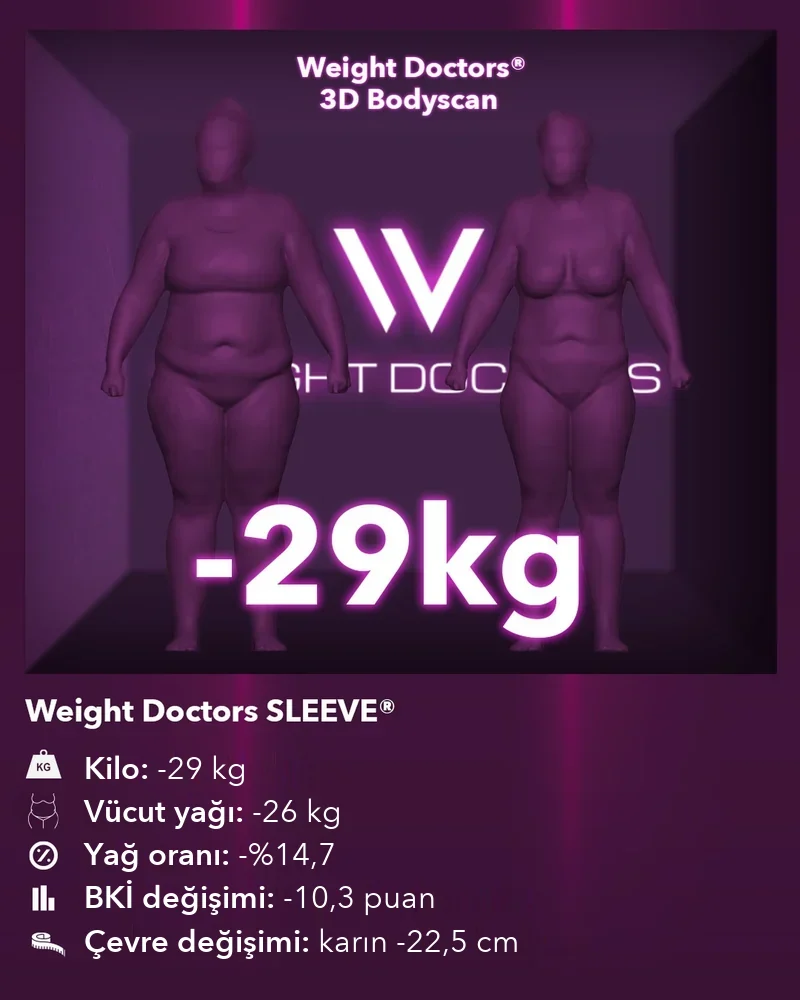 Weight Doctors® 3D Bodyscan öncesi ve sonrası: Weight Doctors SLEEVE® ile 29 kg eksi, vücut yağı 26 kg eksi