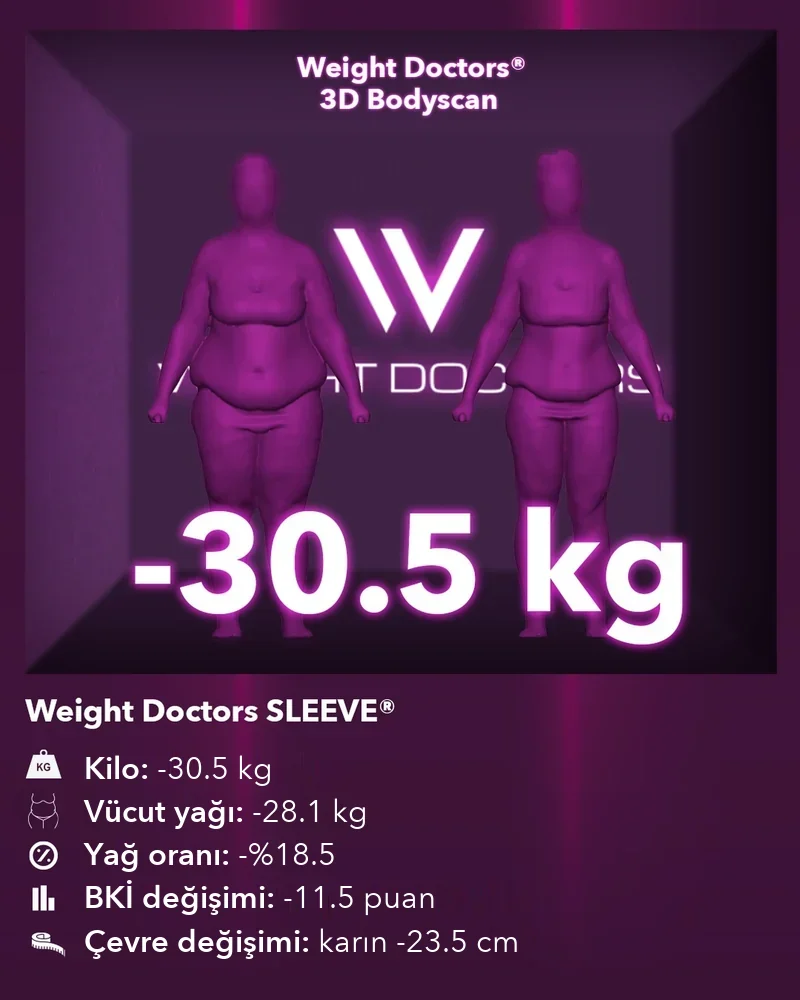 Weight Doctors® 3D Bodyscan öncesi ve sonrası: Weight Doctors SLEEVE® ile 30,5 kg eksi, vücut yağı 28,1 kg eksi