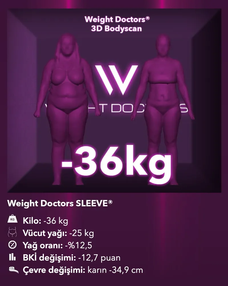Weight Doctors® 3D Bodyscan öncesi ve sonrası: Weight Doctors SLEEVE® ile 36 kg eksi, vücut yağı 25 kg eksi
