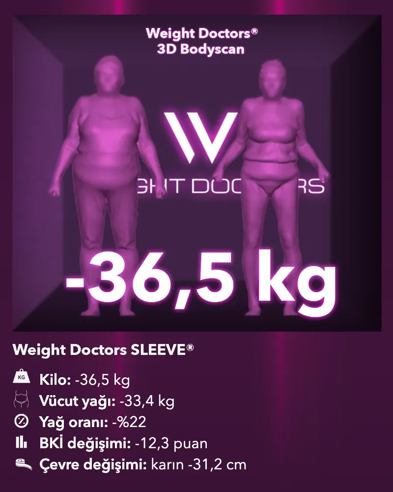 Weight Doctors® 3D Bodyscan öncesi ve sonrası: Weight Doctors SLEEVE® ile 36,5 kg eksi, vücut yağı 33,4 kg eksi