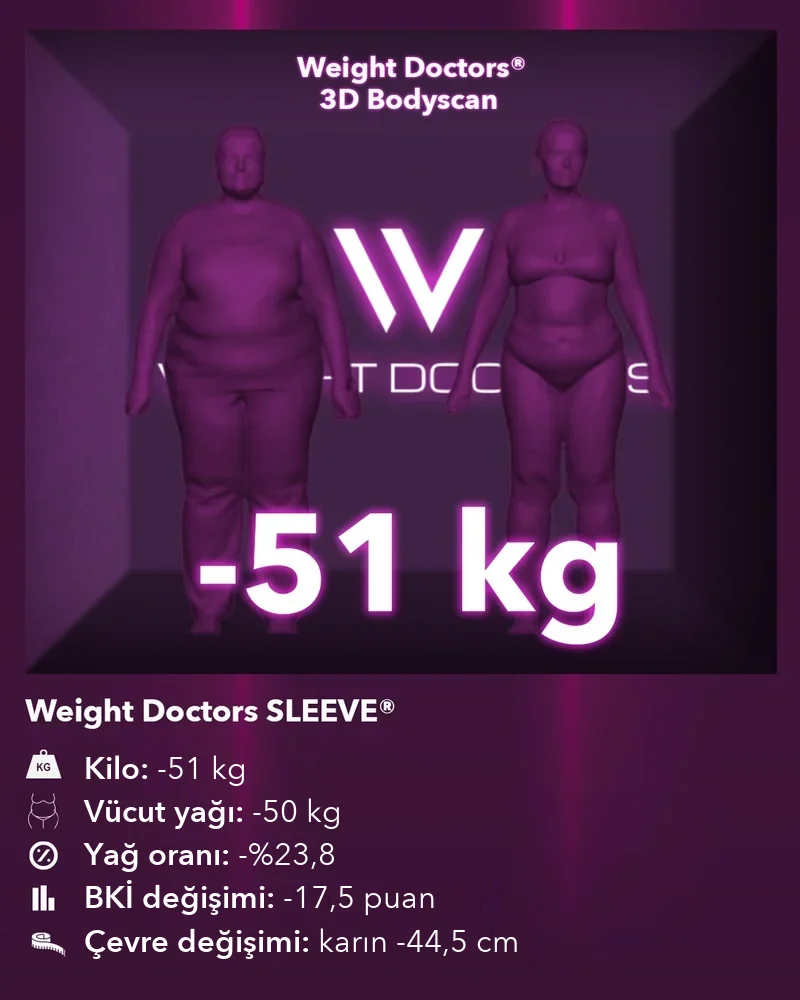 Weight Doctors® 3D Bodyscan öncesi ve sonrası: Weight Doctors SLEEVE® ile 51 kg eksi, vücut yağı 50 kg eksi