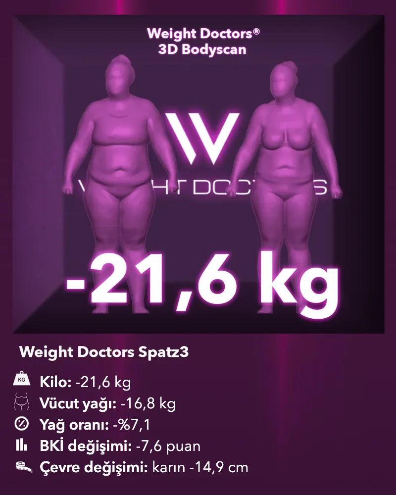 Weight Doctors® 3D Bodyscan öncesi ve sonrası: Spatz3 mide balonuyla 21,6 kg eksi, vücut yağı 16,8 kg eksi